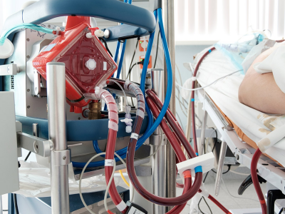 https://www.lung.org/blog/about-ecmo